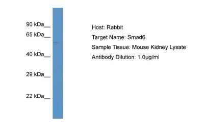 Western Blot: SMAD6 Antibody [NBP2-88311]