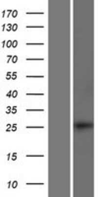 Western Blot: SMAD6 Overexpression Lysate [NBP2-09672]