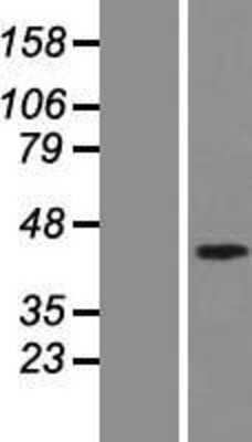 Western Blot: Smad7 Overexpression Lysate [NBP2-07689]