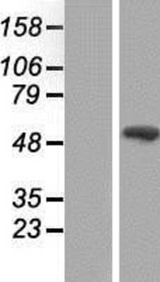 Western Blot: Smad9 Overexpression Lysate [NBP2-07690]