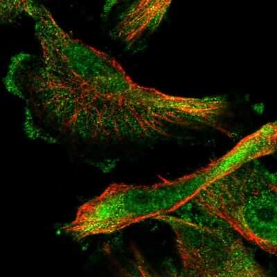 Immunocytochemistry/ Immunofluorescence: SMAGP Antibody [NBP1-81686]