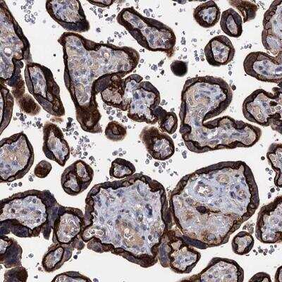 Immunohistochemistry: SMAGP Antibody [NBP1-81686]