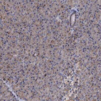 Immunohistochemistry-Paraffin: SMAGP Antibody [NBP1-81686]