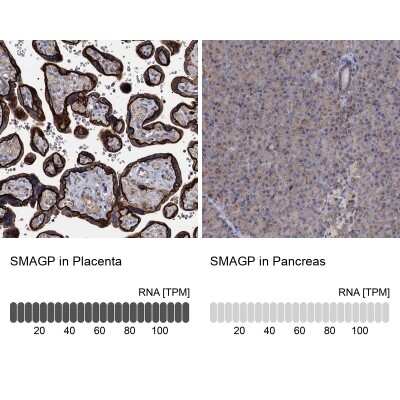 Immunohistochemistry-Paraffin: SMAGP Antibody [NBP1-81686]