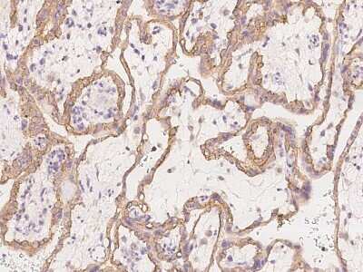 Immunohistochemistry-Paraffin: SMAGP Antibody [NBP3-06324]