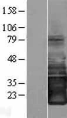 Western Blot: SMAGP Overexpression Lysate [NBL1-12620]