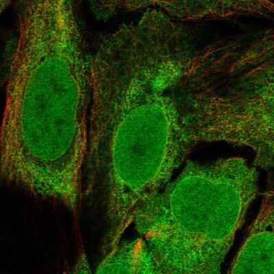 Immunocytochemistry/ Immunofluorescence: SMAP Antibody [NBP2-57456]