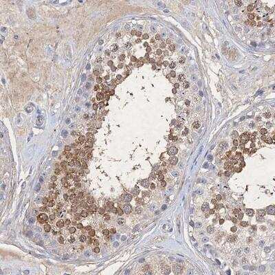 Immunohistochemistry: SMAP Antibody [NBP1-87883]