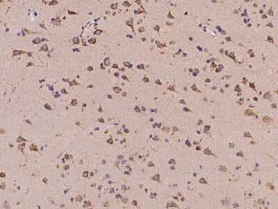 Immunohistochemistry-Paraffin: SMAP Antibody [NBP2-97382]