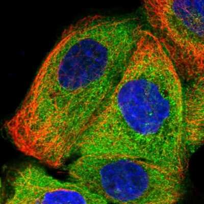 Immunocytochemistry/ Immunofluorescence: SMAP1 Antibody [NBP1-83702]