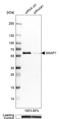 Western Blot: SMAP1 Antibody [NBP1-83702]