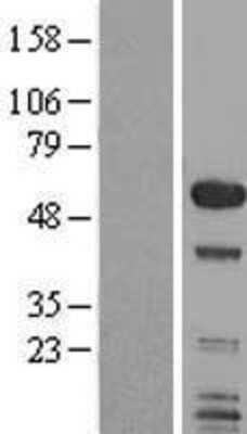 Western Blot: SMAP1 Overexpression Lysate [NBL1-16226]