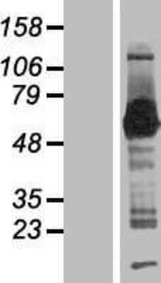 Western Blot: SMAP1 Overexpression Lysate [NBP2-06502]