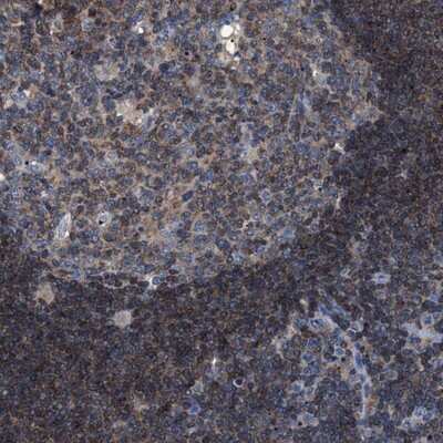 Immunohistochemistry-Paraffin: SMAP2 Antibody [NBP1-80737]