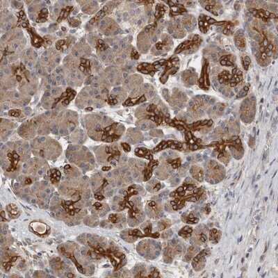 Immunohistochemistry-Paraffin: SMAP2 Antibody [NBP1-80738]