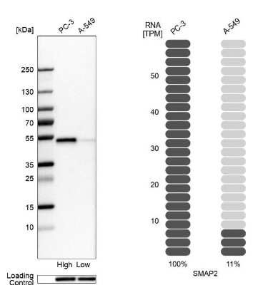 Western Blot: SMAP2 Antibody [NBP1-80737]