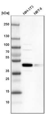 Western Blot: SMAP2 Antibody [NBP1-80737]