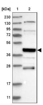 Western Blot: SMAP2 Antibody [NBP1-80738]