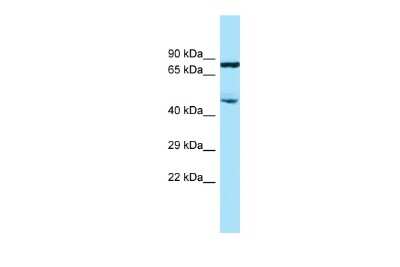 Western Blot: SMAP2 Antibody [NBP2-85774]