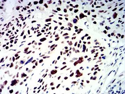 Immunohistochemistry: SMARCA1 Antibody (2H7B8) - BSA Free [NBP2-61879]