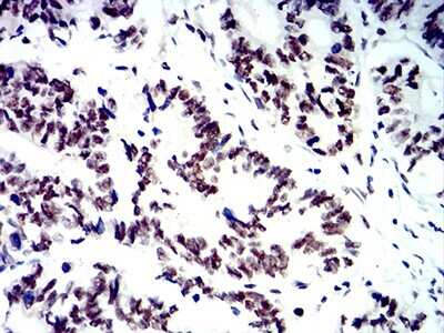 Immunohistochemistry: SMARCA1 Antibody (2H7B8) - BSA Free [NBP2-61879]