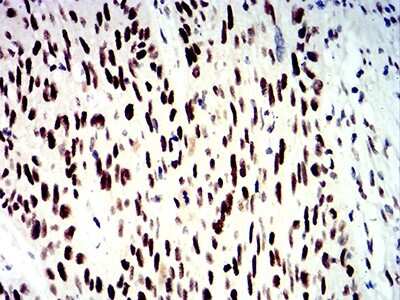 Immunohistochemistry-Paraffin: SMARCA1 Antibody (2H7B9) - BSA Free [NBP2-61882]
