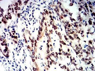 Immunohistochemistry-Paraffin: SMARCA1 Antibody (2H7B9) - BSA Free [NBP2-61882]