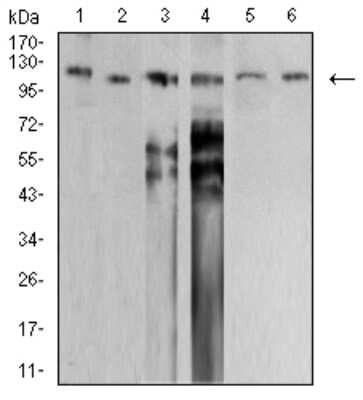 Western Blot: SMARCA1 Antibody (2H7B9)BSA Free [NBP2-61882]