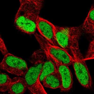 Immunocytochemistry/ Immunofluorescence: SMARCA1 Antibody [NBP2-56279]