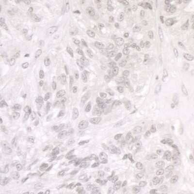 Immunohistochemistry: SMARCA1 Antibody [NB100-57524]