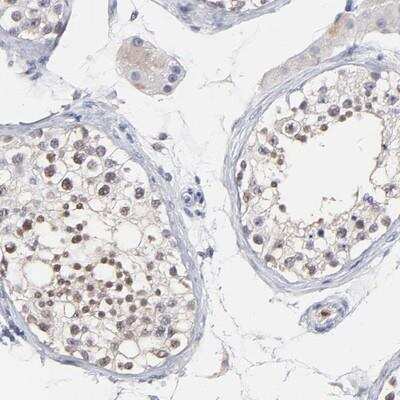 Immunohistochemistry-Paraffin: SMARCA1 Antibody [NBP1-83087]