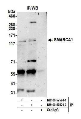 Immunoprecipitation: SMARCA1 Antibody [NB100-57524]