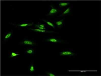 Immunocytochemistry/ Immunofluorescence: SMARCA5/SNF2H Antibody (3F4) [H00008467-M02]