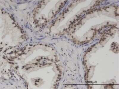 Immunohistochemistry-Paraffin: SMARCA5/SNF2H Antibody (3F4) [H00008467-M02]