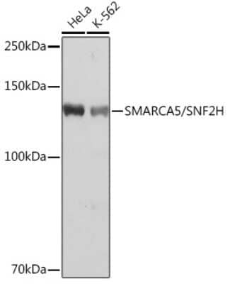 Western Blot: SMARCA5/SNF2H Antibody (6H8I7) [NBP3-16216]
