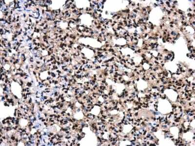 Immunohistochemistry-Paraffin: SMARCA5/SNF2H Antibody [NBP3-12952]