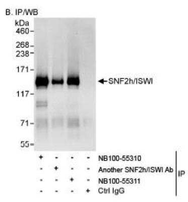 Immunoprecipitation: SMARCA5/SNF2H Antibody [NB100-55311]