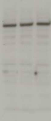 Western Blot: SMARCA5/SNF2H Antibody [NB100-55310]