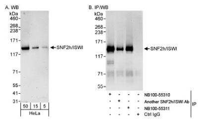 Western Blot: SMARCA5/SNF2H Antibody [NB100-55310]