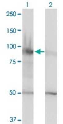 Western Blot: SMARCA6 Antibody (1D10) [H00003070-M01]