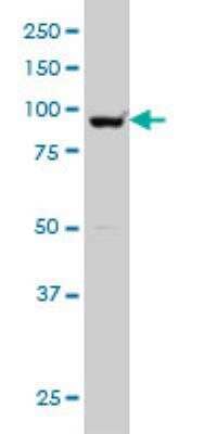 Western Blot: SMARCA6 Antibody (2G10) [H00003070-M04]