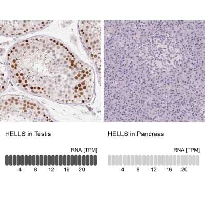 Immunohistochemistry-Paraffin: SMARCA6 Antibody [NBP2-38986]