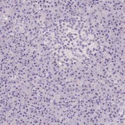 Immunohistochemistry-Paraffin: SMARCA6 Antibody [NBP2-38986]