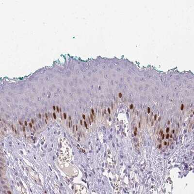 Immunohistochemistry-Paraffin: SMARCA6 Antibody [NBP2-38986]