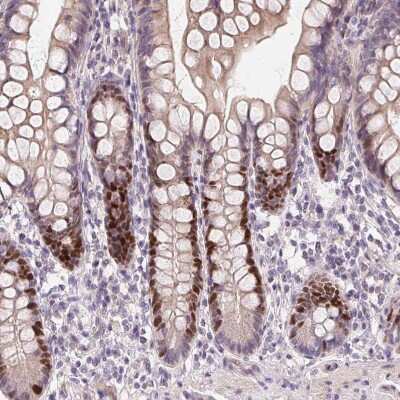 Immunohistochemistry-Paraffin: SMARCA6 Antibody [NBP2-38986]