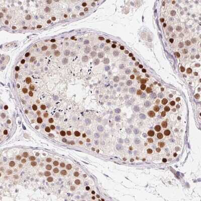 Immunohistochemistry-Paraffin: SMARCA6 Antibody [NBP2-38986]