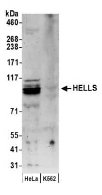 Western Blot: SMARCA6 Antibody [NB100-278]