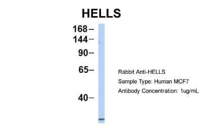 Western Blot: SMARCA6 Antibody [NBP1-57145]