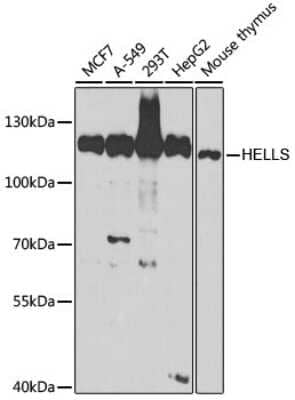 Western Blot: SMARCA6 AntibodyBSA Free [NBP3-03793]