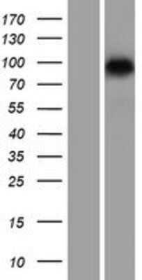 Western Blot: SMARCA6 Overexpression Lysate [NBL1-11502]